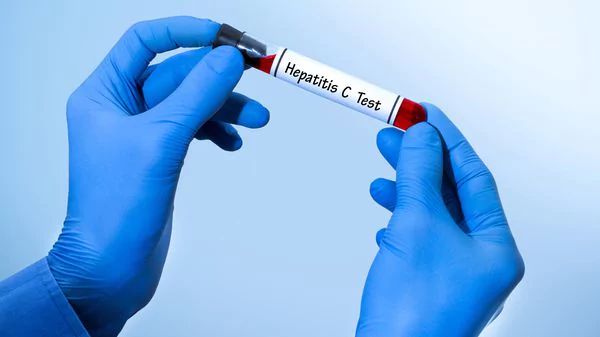 Comodoro Rivadavia integrará una campaña nacional contra la Hepatitis C.